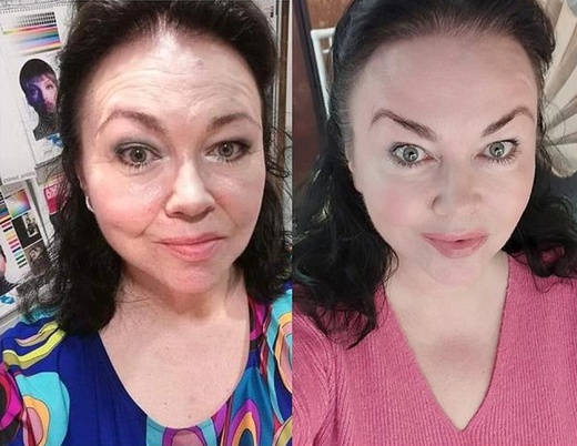 Balíček 6 omlazení přístroji + Obličejová jóga + líčení a foto