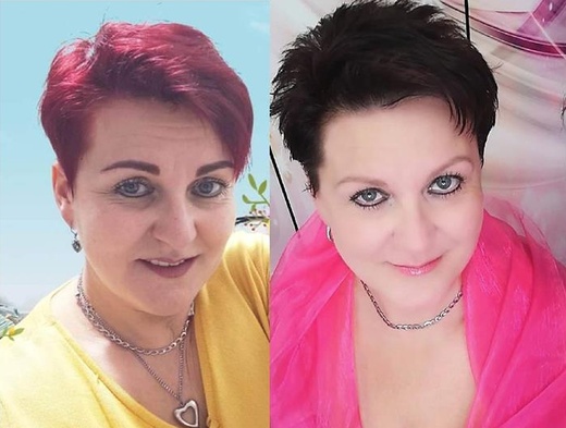 4D omlazení 2 přístroji HIFU a THERMAGE Extra silné