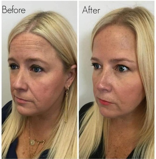 Nu Skin ageLOC Boost a aktivační sérum 40 ml