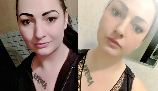 PŘED A PO OBOU SLUŽBÁCH, OŘEZ,po Mikrojehličkování a po H