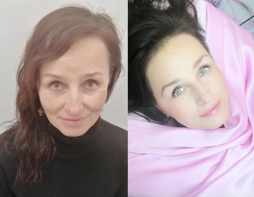 ROSELIPS PŘÍRODNÍ ZABARVENÍ kys. hyaluronová s výtažkem z rybízu