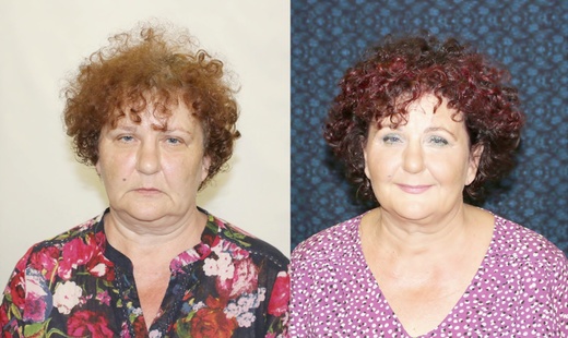 Źena 54 let po 40 dnech cvičení Obličejové jógy