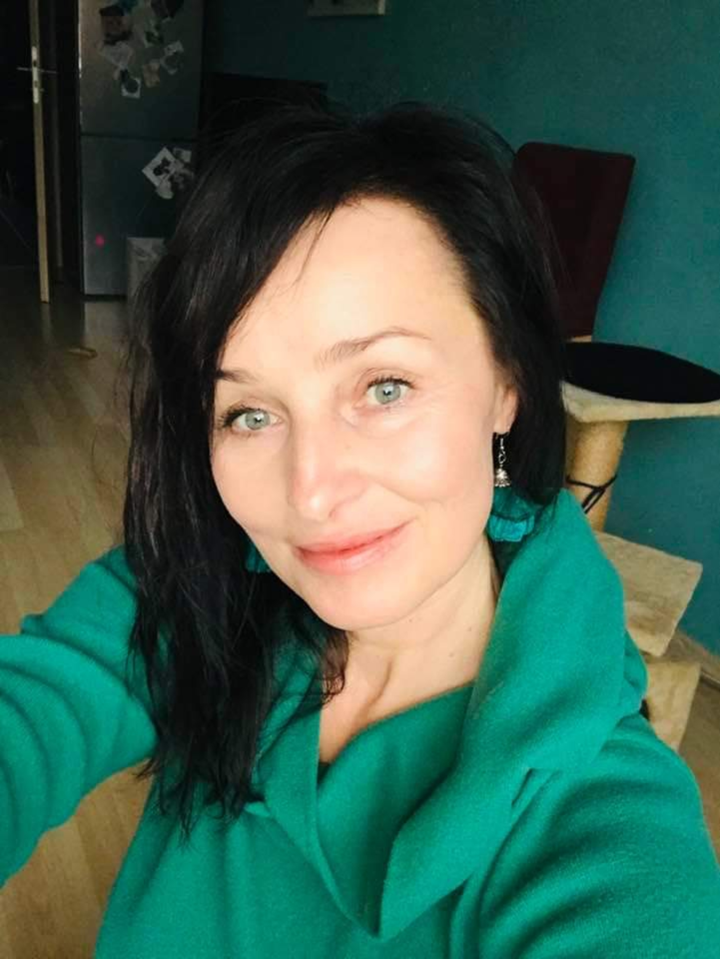 Světlana 3 týdny po Rose Lips a 2,5 měsíce po Thermage